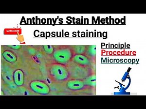 Capsule staining procedure || Anthony's stain Method part -7