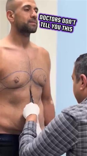 3.4K views · 216 reactions | Current Clinical Trials for Gynecomastia Treatment | Browse Brain | Facebook