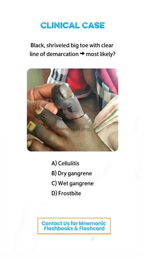 𝑴𝒆𝒅 𝑸𝒖𝒊𝒛𝒛𝒊𝒏𝒈 on Instagram: "Comment “Details” and check your inbox for the full mnemonic flashbook & flashcards! 📕✨ . . . . . . #medical #medicine #medicalstudent #medicinestudent #usmle #step1 #plab #mrcp #medicine #reels #viral #foryou #anatomy #reelexplore #instagram #neurology #nephrology #surgery #students #colleges #cardiology #knowledge #virals #plab #UK #USA #newyork #nyc #neet"