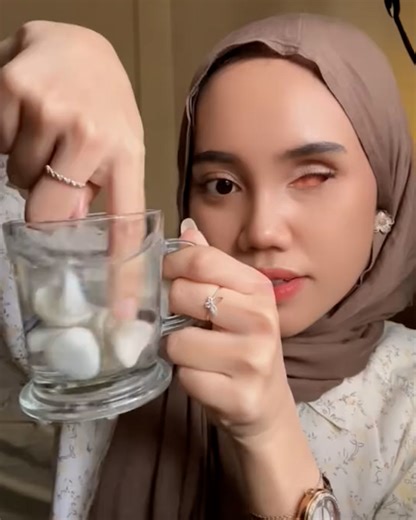 How I clean my prosthetic eye 👁️😯 | Lessons Learned In Life