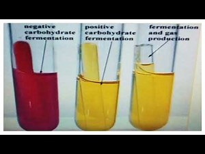 Bacterial Glucose Fermentation Test