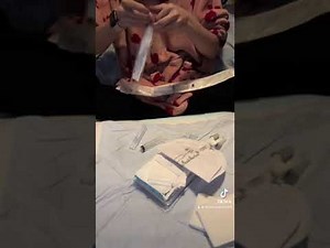 How I set up for a suprapubic catheter change at home.