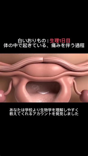 生物|医学|健康の記録 on Instagram: "生理1日目、 体の中では強い生理的プロセスが始まっています。 子宮は、妊娠に備えて厚くなっていた **子宮内膜（エンドメトリウム）**を排出するため、 収縮を繰り返します。 この収縮を引き起こすのが、 プロスタグランジンと呼ばれるホルモン様物質です。 その結果、 下腹部や腰に痛みやけいれんが生じます。 この時期の前後に、 白いおりものに気づく人もいます。 これは**白帯下（leukorrhea）**と呼ばれ、 主に子宮頸部の粘液や古い細胞から構成されています。 白帯下は、 膣内を清潔に保つ役割を持ち、 体内でホルモン変化が進行しているサインでもあります。 生理直前はプロゲステロンが優位で、 出血が始まるとエストロゲンが主導権を引き継ぎます。 体の内側では、 子宮が古い血液や組織を排出し、 血管は収縮し、ホルモンは揺れ動く。 その影響で、 疲労感、気分の変動、痛みが現れます。 これは異常ではありません。 次の周期に向けて体をリセットするための、 自然な更新プロセスです。"