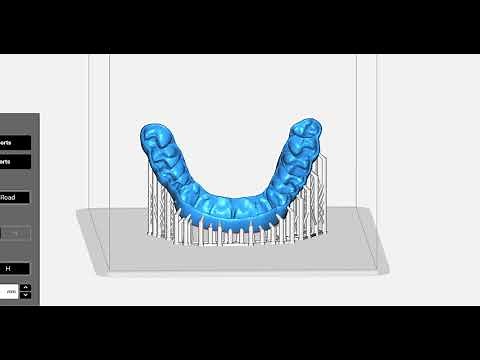 Preparing Night Guards for Print with Keysplint Soft