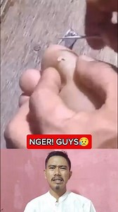 REMOVE THE SPINS IN THE MEAT ||401 #fyp #short #shorts #feedshorts #trending #viral #splinter