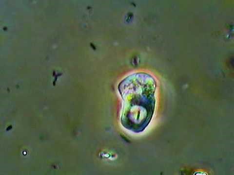 Active Amoeba Feeding