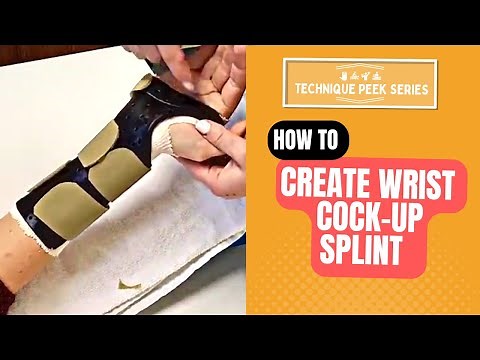 How to Create a Wrist Cock-up Splint | Technique Peek Series