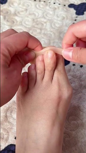 Fix Overlapping Toes Fast! Daily Foot Care Routine#footcare #youtubeshorts #viralvideo
