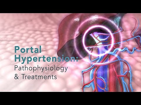 PORTAL HYPERTENSION: Pathophysiology and Common Treatments