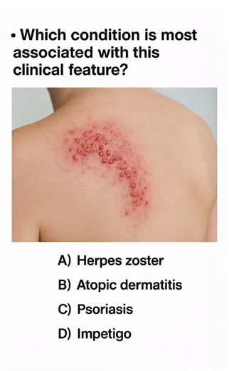 Understanding Dermatology for Medical Students