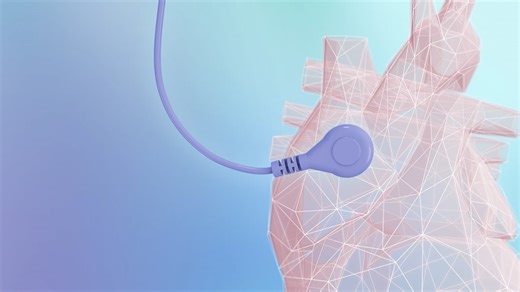 RhythmStar® - A Better Way to Monitor®