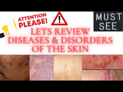 Diseases & Disorders Review|Pictures