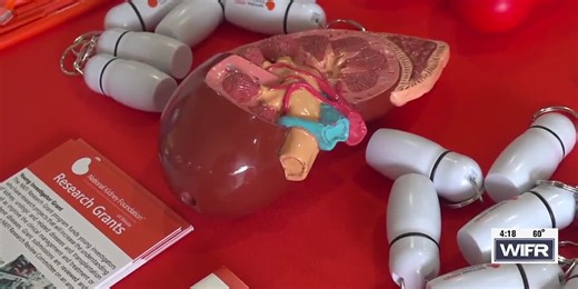 UW Health oncologist shares signs and symptoms of kidney cancer