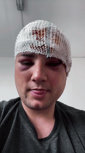 Šypsokis kad ir kaip beskaudetu tie kurie man rase taip ir reikia kai jums kazkas tokio nutiks jus nesijuoksit o galvosit kaip is gyventi o tie kurie mane palaika ačiu jums !!!!