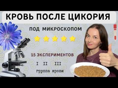 Удивительное действие цикория на кровь ! Полезно знать каждому!