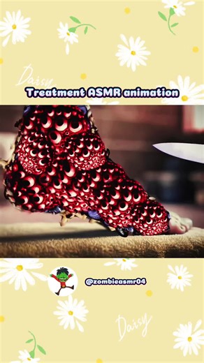 Treatment foots ASMR - Part 1 #asmr #asmrvideos #asmrtiktok #relaxing #satisfyingsounds