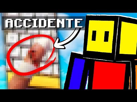 I HAD AN ACCIDENT AND THIS IS HOW I PLAY NOW