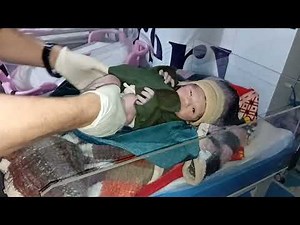 Newborn Baby First Assessment — Initial Health Evaluation