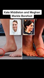 Kate Middleton and Meghan Markle’s feet have bunions and fallen arches after glitzy royal events took their toll#meghanmarkle #katemiddleton #royalfamily #royals #katemiddletonstyle #princeharry #princewilliam | Royal Family Diary | Facebook