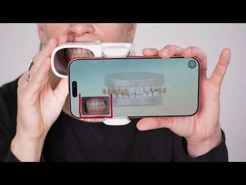 How to scan with your ScanBox Pro waiting for the LED Adapter