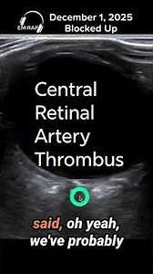 Neurocritical Care Mailbag: POCUS for CRAO