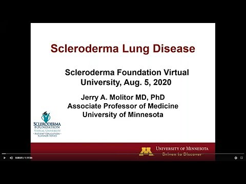 Scleroderma Lung Disease, Jerry Molitor, M.D., Ph.D., University of Minnesota Medical School