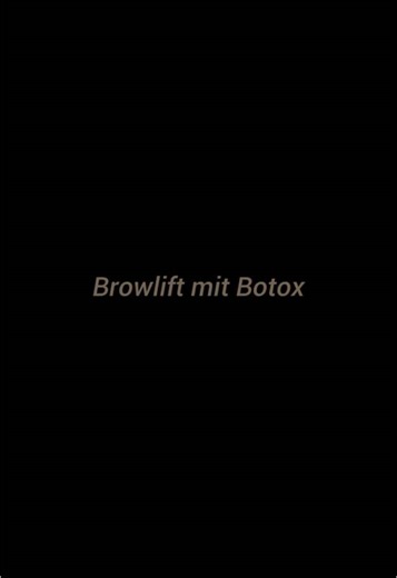 Browlift mit Botox – für einen wachen & frischen Blick! ✨ Möchtest du deine Augenpartie optisch öffnen und einen natürlichen Lifting-Effekt erzielen? Ein sanftes Browlift mit Botox kann genau das bewirken! Ohne OP, ohne Ausfallzeit – für ein jugendliches, offenes Erscheinungsbild. ✅ Hebt die Brauen dezent an. ✅ Lässt die Augen größer & frischer wirken. ✅ Verleiht einen wachen & freundlichen Ausdruck. Schreibt uns gerne für eine Beratung oder kontaktiert uns direkt unter: 0173/ 9715000💉✨ #browli