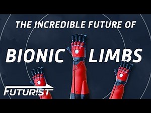 The Future Of Advanced Bionics
