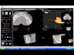 Tutorial CS 3D imaging software. 12-Carestream. Corte Oblicuo & zoom 3D.avi