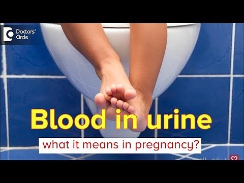 What causes blood in urine during pregnancy? Can it affect pregnancy? - Dr.Shirin Venkatramani of C9