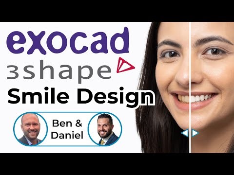 exocad or 3Shape Smile Design? Case Comparison with Ben & Daniel ep 0019
