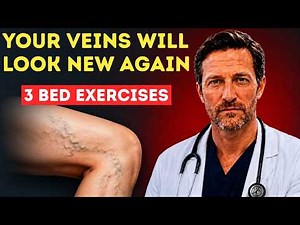 Say Goodbye to Varicose Veins: 3 Simple Bedtime Exercises That May Help Improve Circulation
