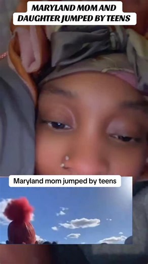 Maryland mom and daughter jumped by a group of teens | Casey Sharp