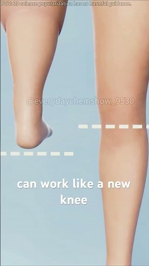 Rotationplasty Explained 3DMedical Animation #Rotationplasty#MedicalAnimation #OrthopedicSurger