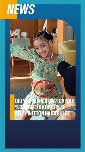 Kulture Cephus: Understanding Belly Button Bulges in Children