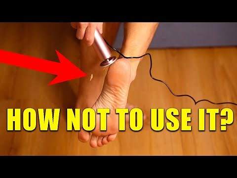 Dermave Electric Foot Callus Remover Review - Does It Really Work? How To Use It Effectively?