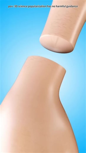 Hand Transplant Surgery 3D Animation #handtransplant #handtransplantsurgery #handtransplantworkout #handtransplantation #handsurgery