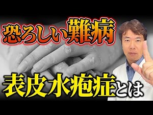 表皮水疱症とは？原因・遺伝・キャリア率を医師が徹底解説