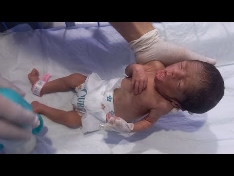 Preterm LBW Baby Strong Comeback 💕 | Condition Improved | Formula Feeding Journey| NICU Care Miracle
