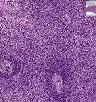 Shotgun Histology Spleen