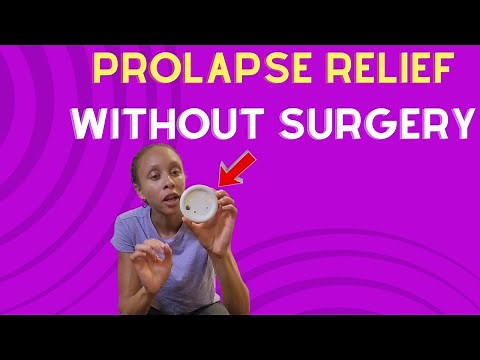 Prolapse Relief Without Surgery
