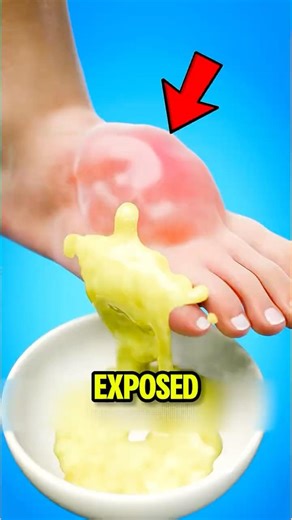 What Happens When You Pop a Blister 😬