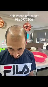 665 reactions · 15 comments | HAIR TRANSPLANT: Anamnagar kathmandu. Near bajeko sekuwa anamnagar. You can find the exact location on google maps also if you search for “kathmandu clinic of cosmetic surgery”. Or you may call 015707056 or 9860777206 for details. | Dr. Suyog Mainali, Plastic Surgeon | Facebook