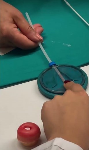 Copper T insertion technique!