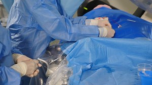 Vascular Surgery. Radiologist Performs Endovascular Operation with Angiography Machine Stock Footage - Video of clinic, stent: 237951600