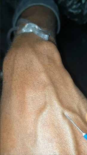 Easy canulation, #cannulation