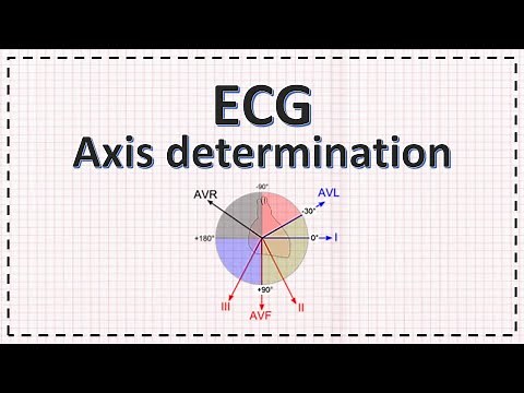 Cardiac Axis Determination | ECG Axis | Simplified