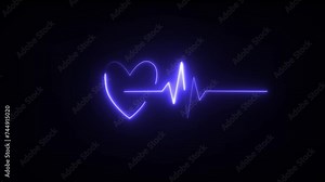 This is an electrical activity of heart. Which is demonstrated by electrocardiogram. This activity can show various type of disease of heart.