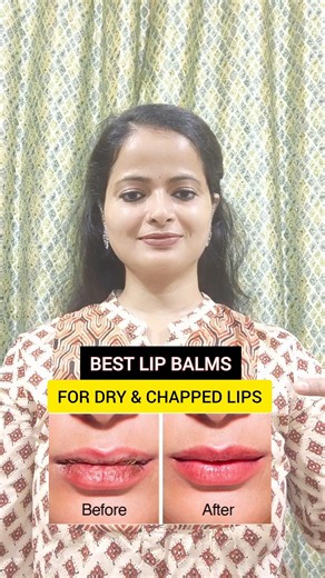 💋 DRY & CHAPPED LIPS? TRY THESE BEST LIP BALMS! 😍✨ #skincare #shorts