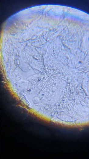 human cheek cells under a microscope